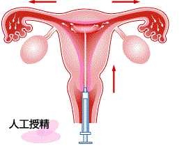 香港验血找香港迪亚预约中心,人工受孕包括人工授精和试管婴儿，两者的不同